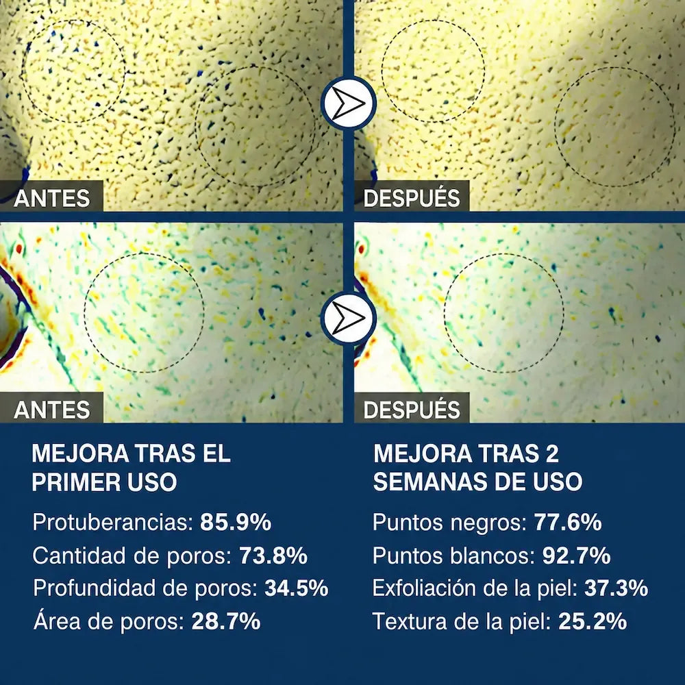 Crystal Skin Pro™ — Mascarilla Purificante Anti-Imperfecciones